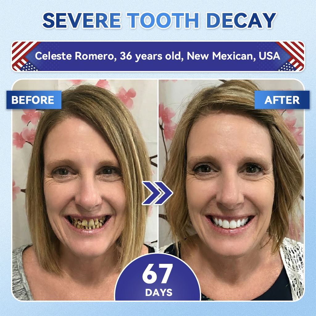 Only 10 boxes left! 🎁𝐆𝐥𝐢𝐦𝐦𝐞𝐫𝐥𝐲® score an exclusive 30% off today! Endorsed by endocrinologists — 4 to 6 boxes recommended to keep the weight off and avoid rebound. Last chance before the new year rolls around — don’t miss out! 🎁